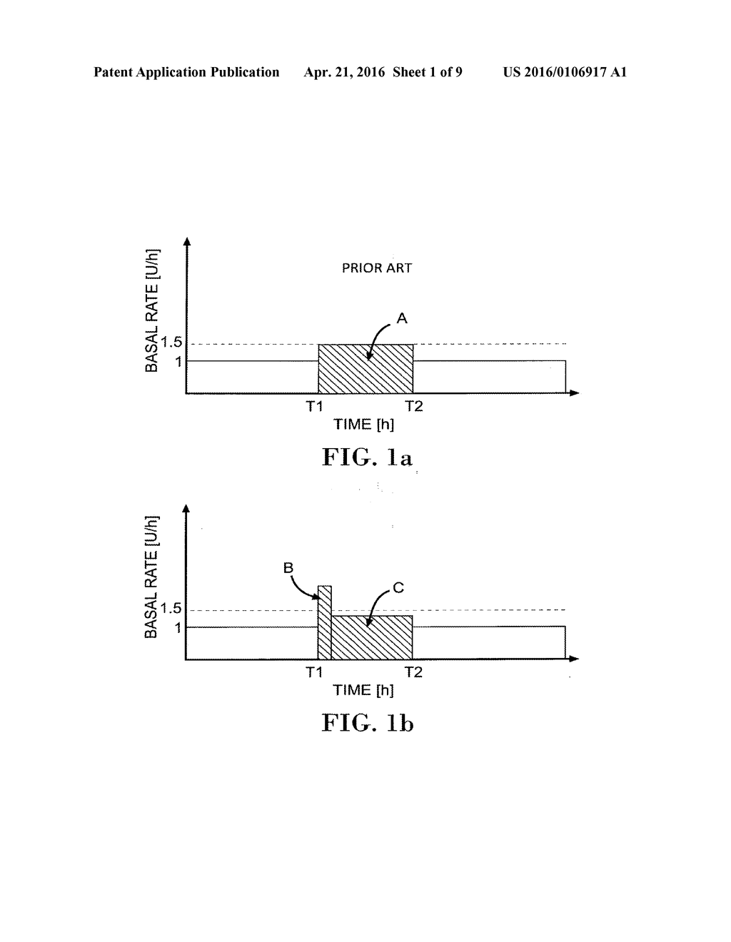 DEVICES AND METHODS FOR ADJUSTING BASAL DELIVERY PROFILE - diagram, schematic, and image 02