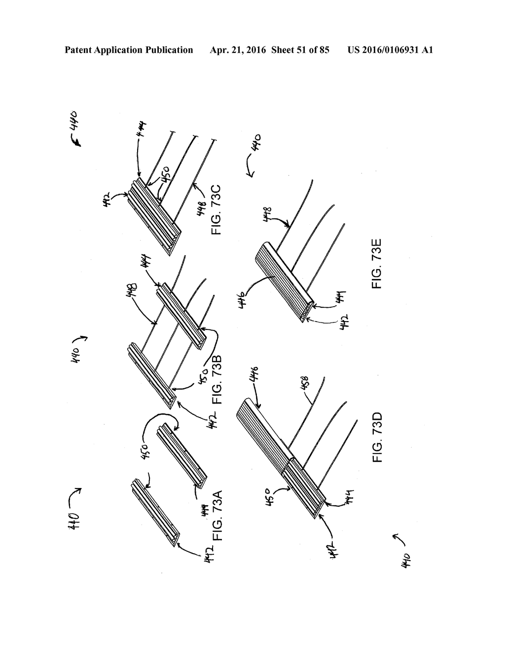 RAPID CLOSING SURGICAL CLOSURE DEVICE - diagram, schematic, and image 52