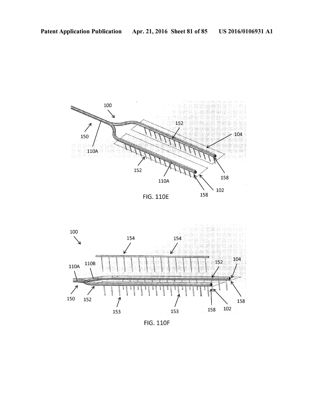 RAPID CLOSING SURGICAL CLOSURE DEVICE - diagram, schematic, and image 82