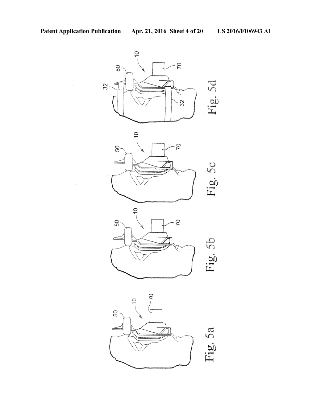 MASK WITH INTEGRAL CUSHION AND FOREHEAD PIECE - diagram, schematic, and image 05