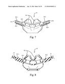 MASK ASSEMBLY SUPPORTING ARRANGEMENTS diagram and image