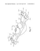 MASK ASSEMBLY SUPPORTING ARRANGEMENTS diagram and image