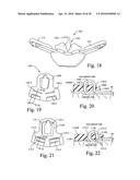 MASK ASSEMBLY SUPPORTING ARRANGEMENTS diagram and image