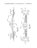 MASK ASSEMBLY SUPPORTING ARRANGEMENTS diagram and image