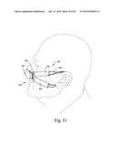 MASK ASSEMBLY SUPPORTING ARRANGEMENTS diagram and image