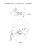 MASK ASSEMBLY SUPPORTING ARRANGEMENTS diagram and image