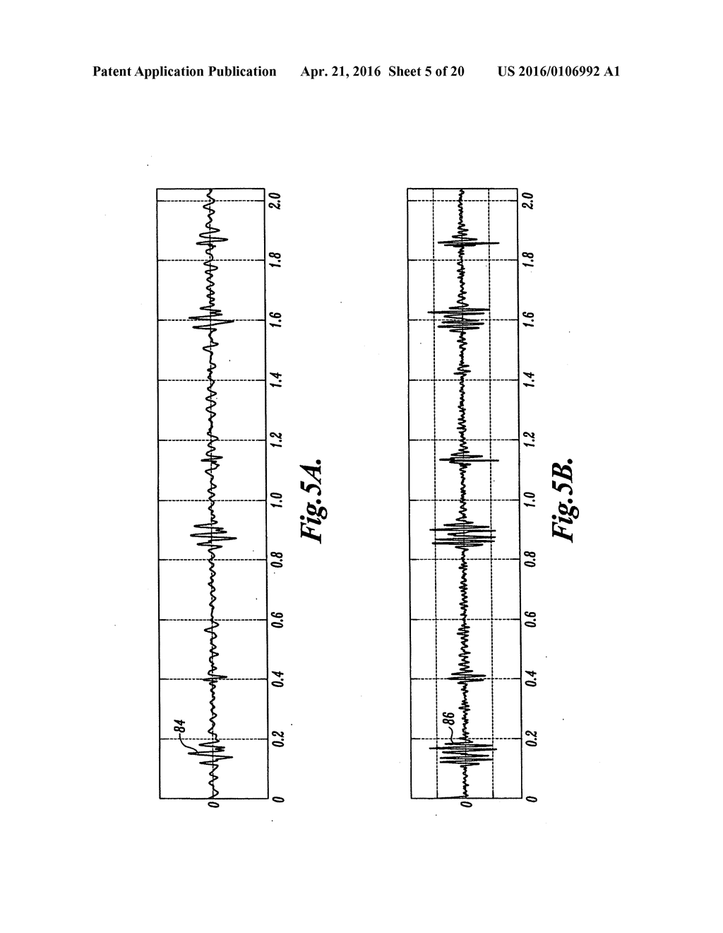 PULSE DETECTION APPARATUS, SOFTWARE, AND METHODS USING PATIENT     PHYSIOLOGICAL SIGNALS - diagram, schematic, and image 06