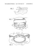 ROTATABLE FOOTPLATE INTEGRATED WITH BEARING ASSEMBLY IMBEDDED IN A     SINGLE-BOARD SPORT BOARD diagram and image