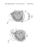 Sifting Bag and Method for Storing and Sorting Plant Materials and Foods diagram and image