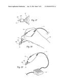 Art Medium Surface Treatment Tool diagram and image