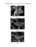 INFLAMMATORY DISEASE DIAGNOSIS AND METHODS OF TREATMENT USING     LIPOPOLYSACCHARIDES-RESPONSIVE BEIGE-LIKE ANCHOR diagram and image