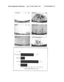 Compositions And Methods For Macular Degeneration diagram and image