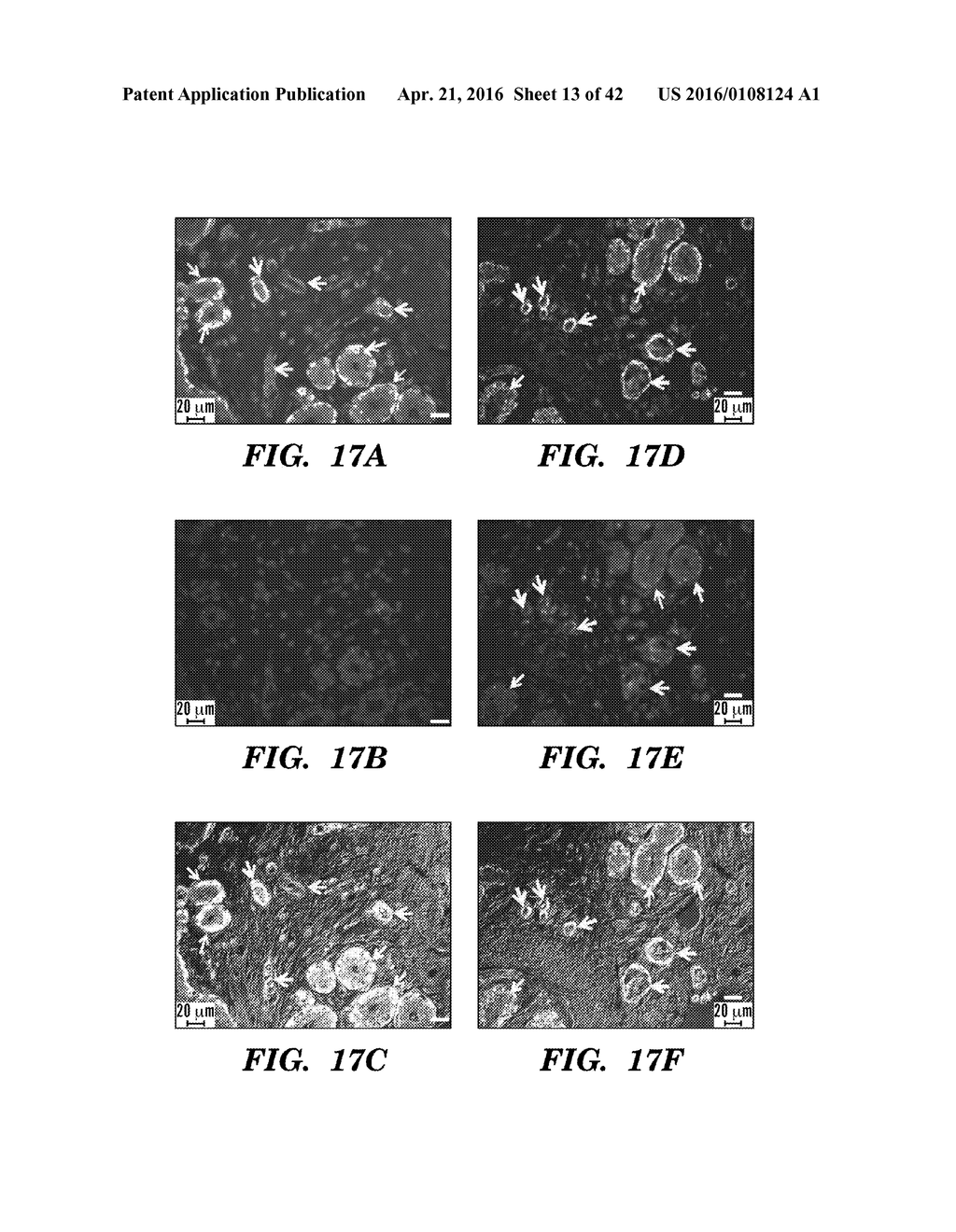 ANTI-DEspR INHIBITORS AS THERAPEUTICS FOR INHIBITION OF PATHOLOGICAL     ANGIOGENESIS AND TUMOR CELL INVASIVENESS AND FOR MOLECULAR IMAGING AND     TARGETED DELIVERY - diagram, schematic, and image 14