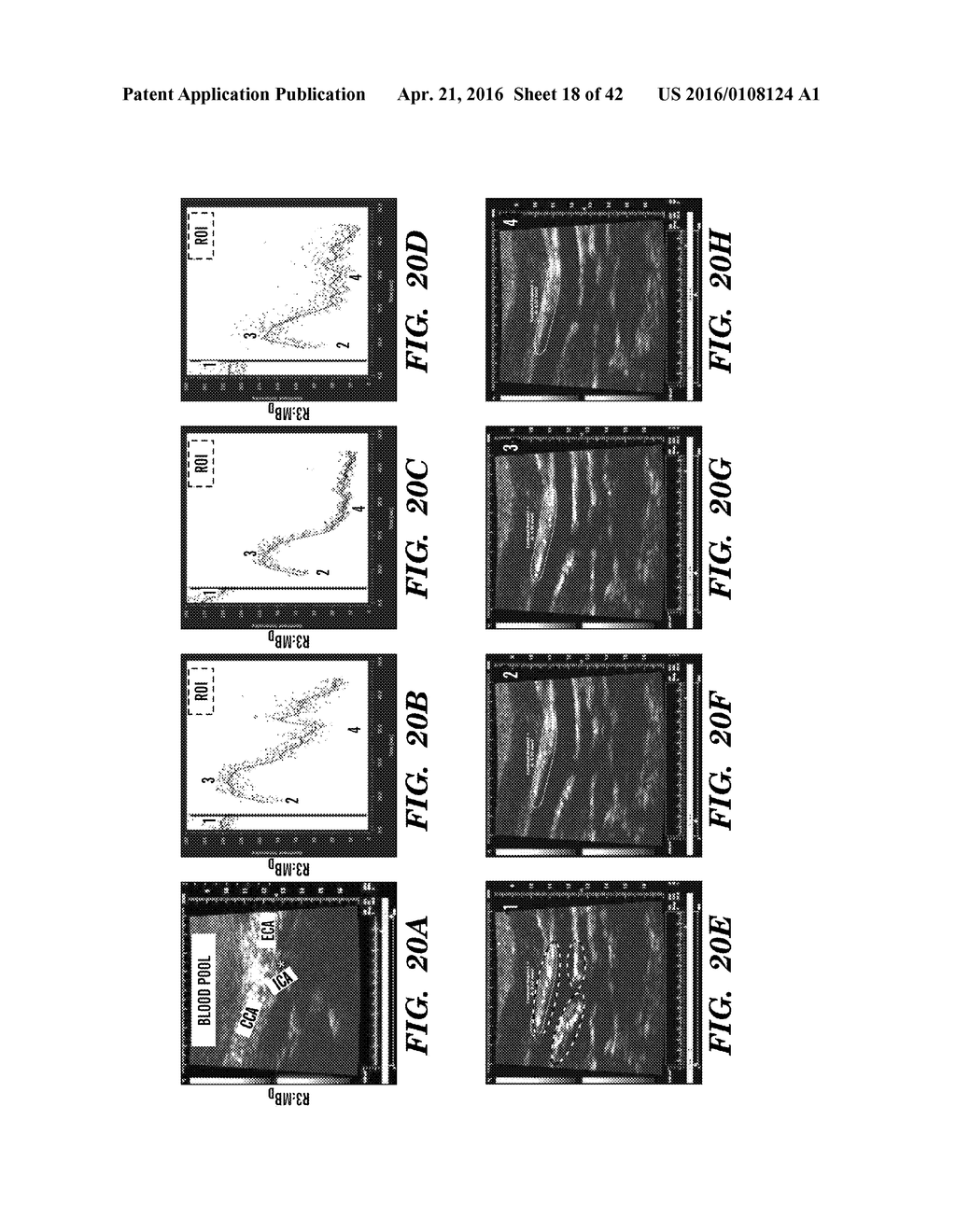 ANTI-DEspR INHIBITORS AS THERAPEUTICS FOR INHIBITION OF PATHOLOGICAL     ANGIOGENESIS AND TUMOR CELL INVASIVENESS AND FOR MOLECULAR IMAGING AND     TARGETED DELIVERY - diagram, schematic, and image 19