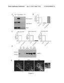 GENE-THERAPY VECTORS FOR TREATING CARDIOMYOPATHY diagram and image