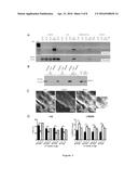 GENE-THERAPY VECTORS FOR TREATING CARDIOMYOPATHY diagram and image