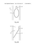 DOWNHOLE TOOL WITH RETRIEVABLE ELECTRONICS diagram and image