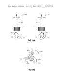 METHOD AND SYSTEM FOR VARIABLE CAM TIMING DEVICE diagram and image