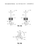 METHOD AND SYSTEM FOR VARIABLE CAM TIMING DEVICE diagram and image