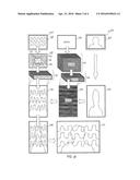 Radial Lenticular Blending Effect diagram and image