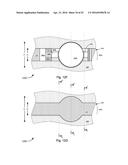 Apical Radiator diagram and image