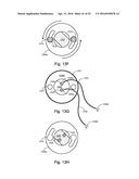 Apical Radiator diagram and image