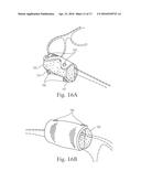 Accessory for Glasses diagram and image