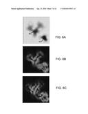 FIBER TRACTOGRAPHY USING ENTROPY SPECTRUM PATHWAYS diagram and image