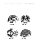 FIBER TRACTOGRAPHY USING ENTROPY SPECTRUM PATHWAYS diagram and image