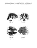 FIBER TRACTOGRAPHY USING ENTROPY SPECTRUM PATHWAYS diagram and image