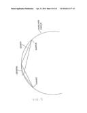 X-RAY SOURCE diagram and image