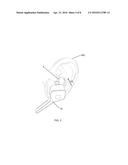 Ear Tip with Stabilizer diagram and image