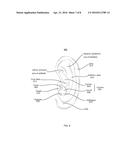 Ear Tip with Stabilizer diagram and image