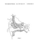 CONTROL BUTTON CONFIGURATIONS FOR AUDITORY PROSTHESES diagram and image