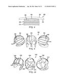 IMPACT AND EXPLOSIVE FORCE MINIMIZATION STRUCTURES diagram and image