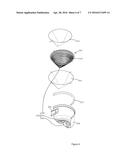 DUST-CONTAINER ASSEMBLY OF VACUUM CLEANER diagram and image