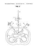 SURGICAL DEVICE diagram and image