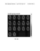 Functional Magnetic Resonance Imaging (fMRI) Methodology Using Transverse     Relaxation Preparation and Non-Echo-Planar Imaging (EPI) Pulse Sequences diagram and image