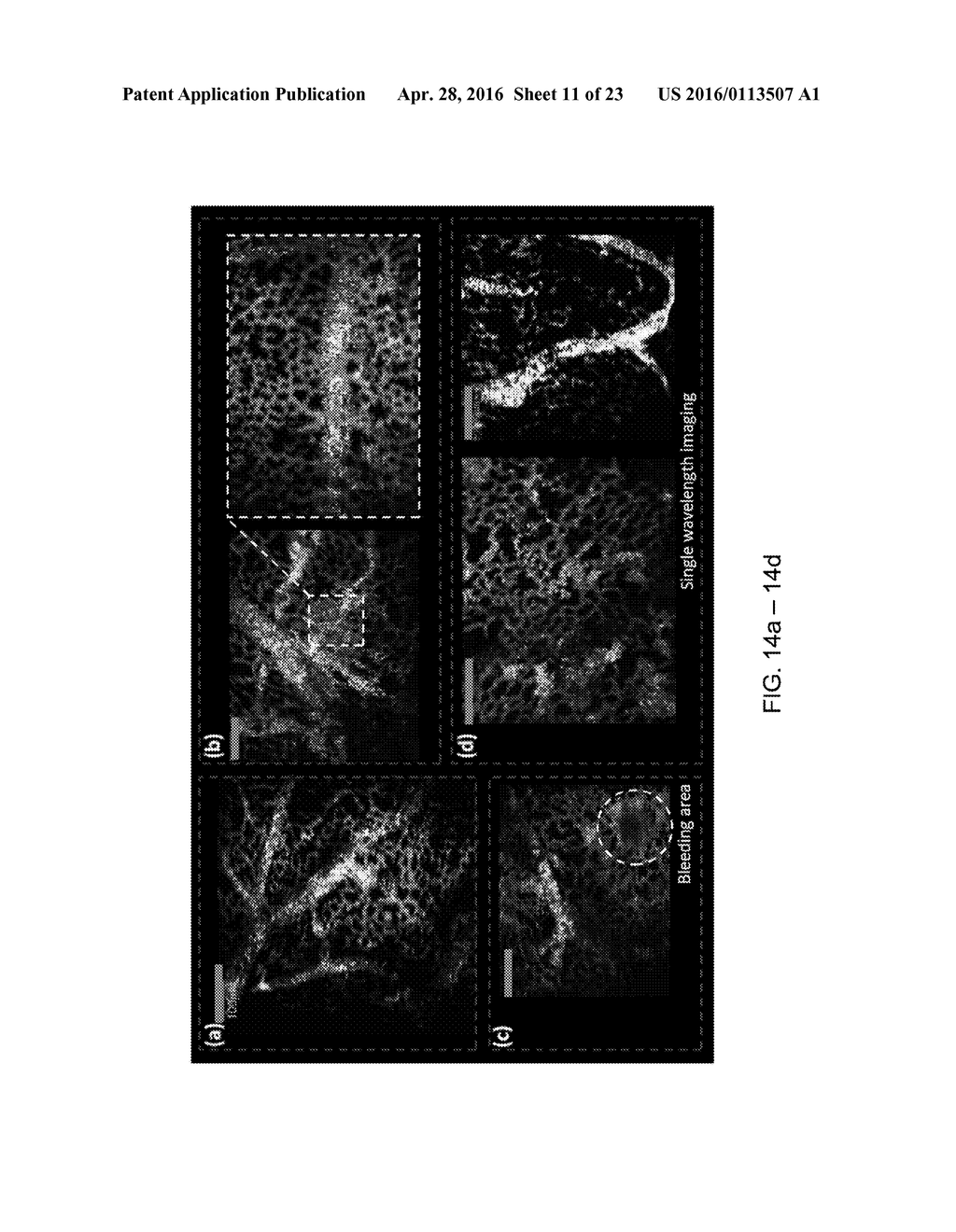 PHOTOACOUSTIC REMOTE SENSING (PARS) - diagram, schematic, and image 12