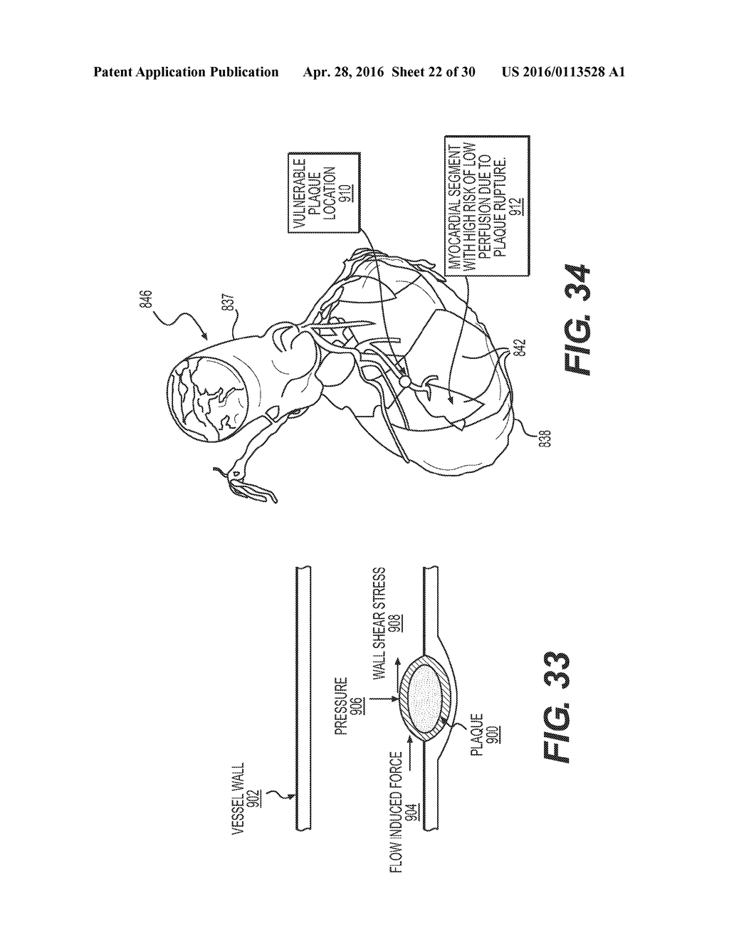 METHOD AND SYSTEM FOR IMAGE PROCESSING TO DETERMINE PATIENT-SPECIFIC BLOOD     FLOW CHARACTERISTICS - diagram, schematic, and image 23