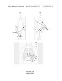 DETECTION AND MONITORING USING HIGH FREQUENCY ELECTROGRAM ANALYSIS diagram and image