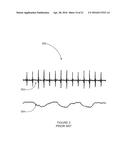 DETECTION AND MONITORING USING HIGH FREQUENCY ELECTROGRAM ANALYSIS diagram and image