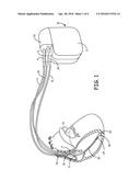 ATRIAL ARRHYTHMIA DETECTION DURING INTERMITTENT INSTANCES OF VENTRICULAR     PACING IN A CARDIAC MEDICAL DEVICE diagram and image