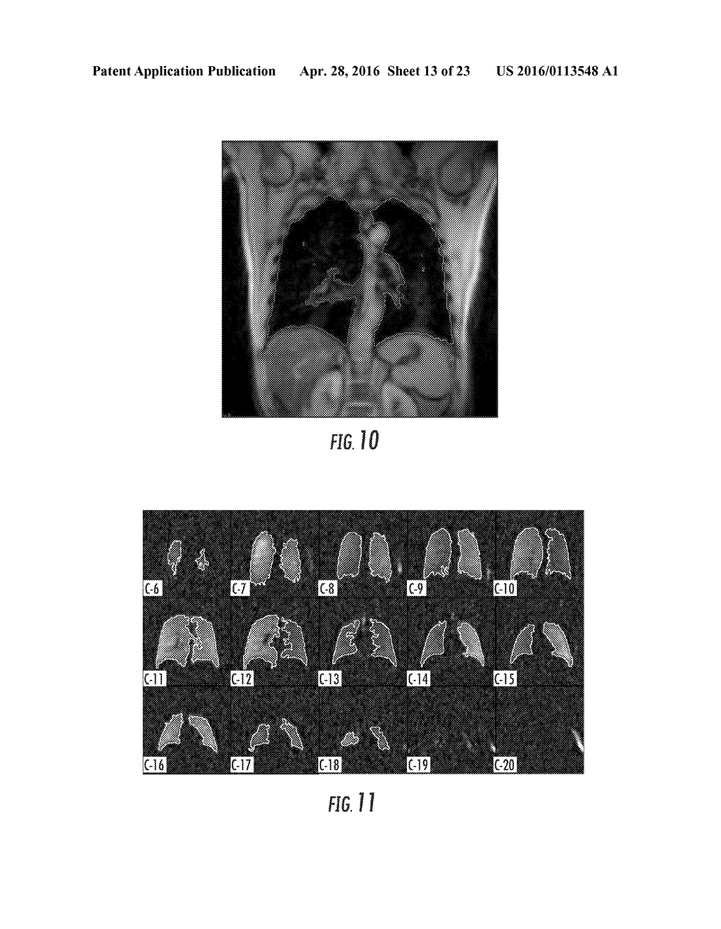 SYSTEMS, METHODS, COMPOSITIONS AND DEVICES FOR IN VIVO MAGNETIC RESONANCE     IMAGING OF LUNGS USING PERFLUORINATED GAS MIXTURES - diagram, schematic, and image 14