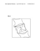 METHOD FOR THE FULLY AUTOMATIC DETECTION AND ASSESSMENT OF DAMAGED     VERTEBRAE diagram and image