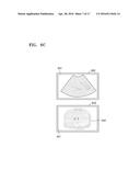 ULTRASOUND DIAGNOSIS APPARATUS AND METHOD AND COMPUTER-READABLE STORAGE     MEDIUM diagram and image