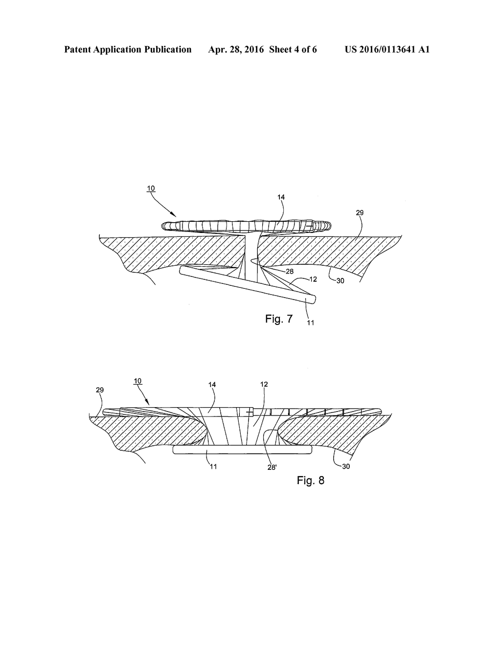 Wound Protector - diagram, schematic, and image 05