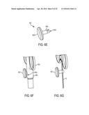 Biceps Tenodesis Delivery Tools diagram and image