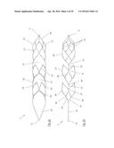 CLOT RETRIEVAL DEVICE FOR REMOVING CLOT FROM A BLOOD VESSEL diagram and image