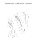 CLOT RETRIEVAL DEVICE FOR REMOVING CLOT FROM A BLOOD VESSEL diagram and image
